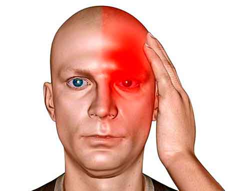 Головная боль в области лба и глаз: причины, диагностика, лечение