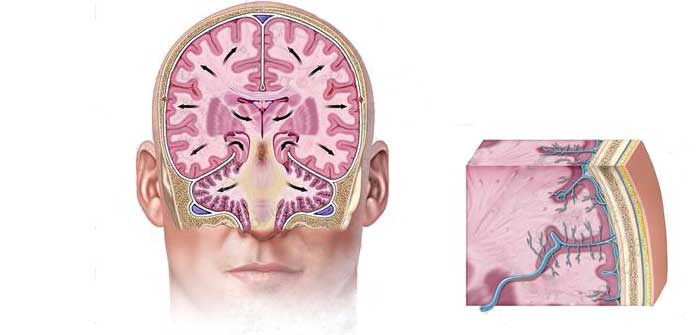 Отек головного мозга: причины, лечение и последствия