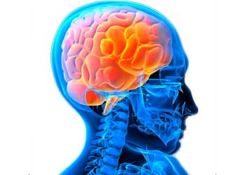 Что лучше сделать мрт или кт головного мозга при частых головных болях thumbnail
