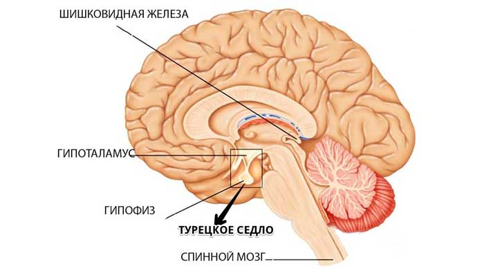 Турецкое седло в головном мозге