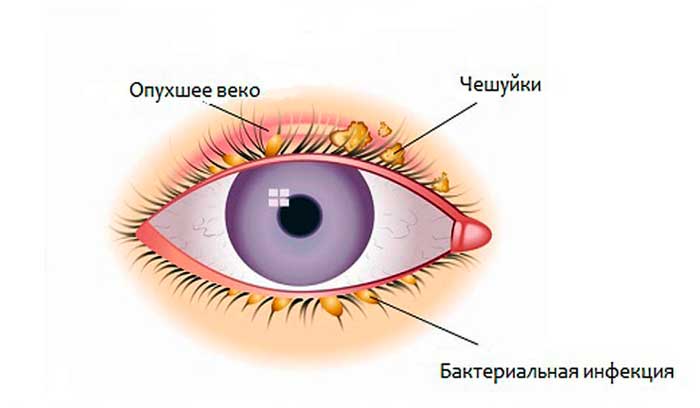 Боль в глазу (резкая, острая): причины