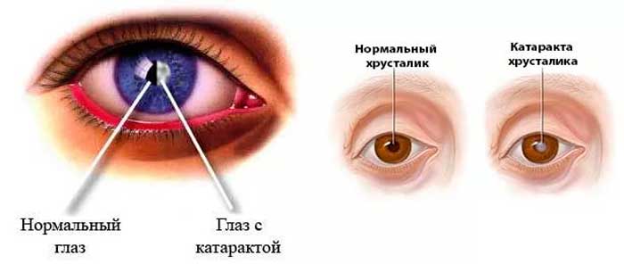 Причины и лечение боли в глазах