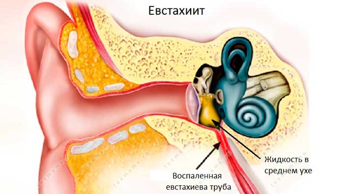 Болит голова за ухом справа: патологии органов слуха, методы обследования и терапии, эффективность народной медицины