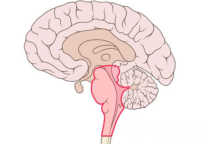 Опухоль ствола головного мозга